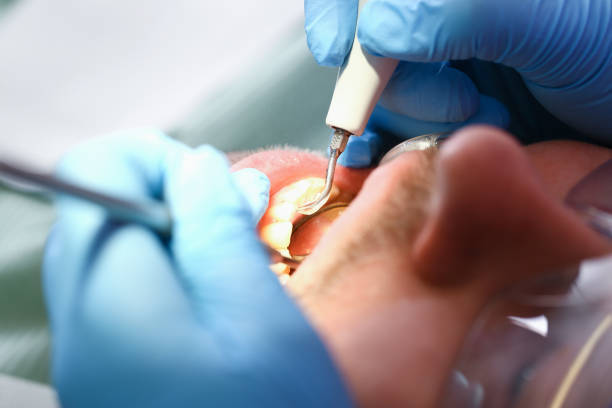 Best Urgent Tooth Repair  in Fox Farm College, WY