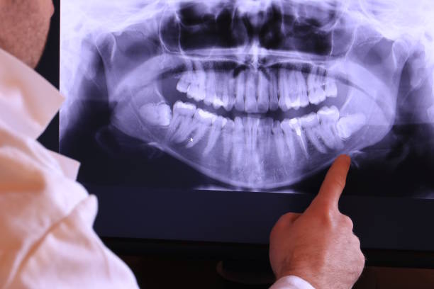 Best Tooth Infection Emergency Dentist  in Fox Farm College, WY