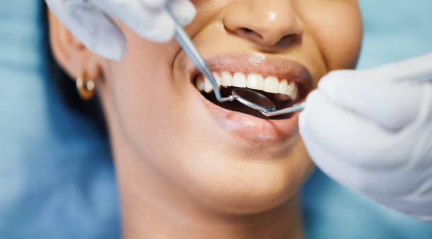 Best Cracked Tooth Emergency Dentist  in Fox Farm College, WY