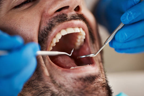 Best Tooth Pain Emergency Relief  in Fox Farm College, WY