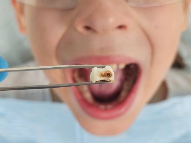 Dentist for Dental Trauma in WY