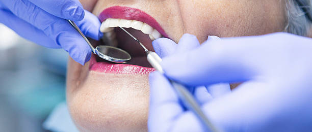 Best Teeth Whitening  in Fox Farm College, WY